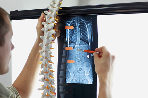 Chiropractors can provide scoliosis treatment.